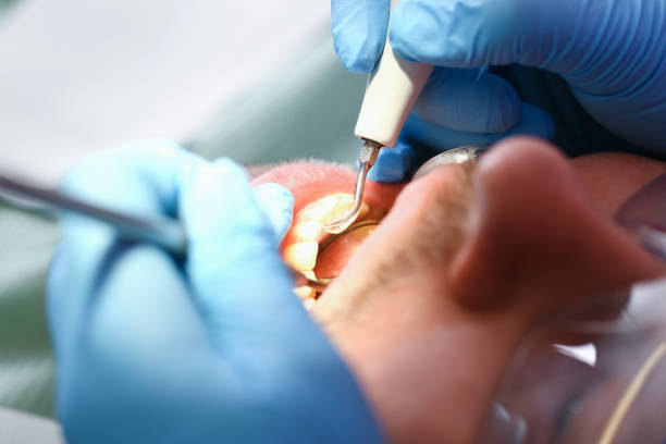 Best Walk-In Emergency Dental Services in Reading, OH
