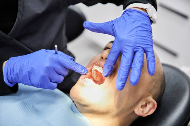 Best Dental Abscess Treatment in Reading, OH